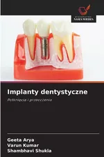 Implanty dentystyczne - Geeta Arya