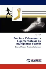 Fracture Calcaneum - Ligamentotaxis by multiplaner Fixator - Ajai Singh