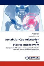 Acetabular Cup Orientation in Total Hip Replacement - Abhishek Kini