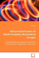 Automated Fusion of Multi-modality Biomedical Images - Hua Cao