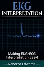 EKG Interpretation - Rebecca Edwards