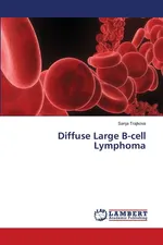 Diffuse Large B-cell Lymphoma - Sanja Trajkova