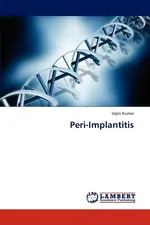 Peri-Implantitis - Vipin Kumar