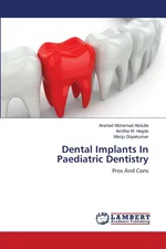 Dental Implants In Paediatric Dentistry - Anshad Mohamed Abdulla