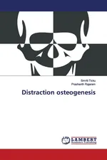 Distraction osteogenesis - Smriti Ticku