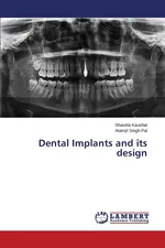 Dental Implants and Its Design - Shaveta Kaushal