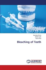 Bleaching of Teeth - Anamika Sinha