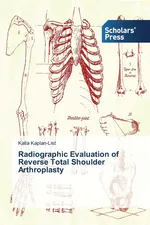 Radiographic Evaluation of Reverse Total Shoulder Arthroplasty - Katia Kaplan-List