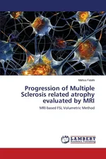 Progression of Multiple Sclerosis related atrophy evaluated by MRI - Mahsa Fatahi