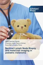 Sentinel Lymph Node Biopsy and molecular imaging in pediatric melanoma - Aguilar Marta Sánchez
