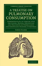 A   Treatise on Pulmonary Consumption - James Clark