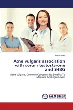 Acne vulgaris association with serum testosterone and SHBG - Asma Javed