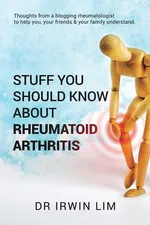 Stuff you should know about Rheumatoid Arthritis - Dr Irwin Lim