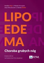 Lipoedema - Karolina Chęś