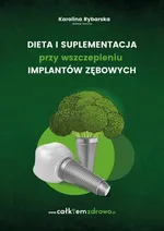 Dieta i suplementacja przy wszczepieniu implantów zębowych - Karolina Rybarska