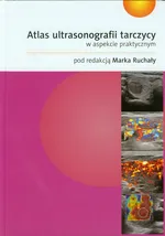 Atlas ultrasonografii tarczycy w aspekcie praktycznym