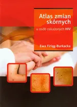 Atlas zmian skórnych u osób zakażonych HIV - Ewa Firląg-Burkacka