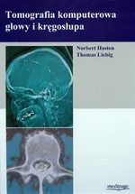 Tomografia komputerowa głowy i kręgosłupa - Norbert Hosten