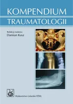 Kompendium traumatologii - Outlet