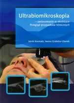 Ultrabiomikroskopia - zastosowanie w okulistyce - Outlet - Iwona Grabska-Liberek