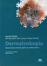 Dermatoskopia Algorytmiczna metoda oparta na analizie wzorca - Alan Cameron
