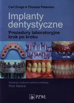 Implanty dentystyczne - Carl Drago