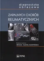 Diagnostyka obrazowa zapalnych chorób reumatycznych - Outlet - Iwona Sudoł-Szopińska