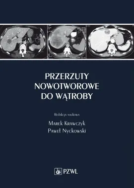 Przerzuty nowotworowe do wątroby - Marek Krawczyk, Paweł  Nyckowski