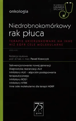 Niedrobnokomórkowy rak płuca W gabinecie lekarza specjalisty - Krawczyk Paweł