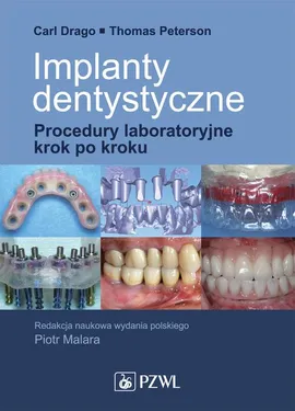 Implanty dentystyczne. Procedury laboratoryjne krok po kroku - Carl Drago, Thomas Peterson