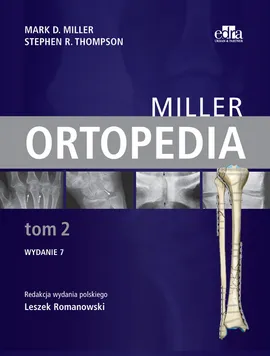 Ortopedia Miller Tom 2 - Miller M.D., Thompson S.R.