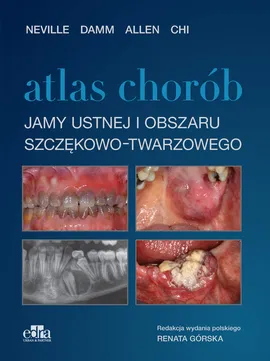 Atlas chorób jamy ustnej i obszaru szczękowo-twarzowego - C.M. Allen, Chi  A.C., D.D Damm, Neville  B.W.