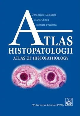 Atlas histopatologii.Tajemniczy świat chorych komórek człowieka - Elżbieta Urasińska, Maria Chosia, Wenancjusz Domagała