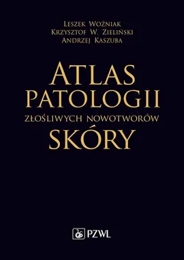 Atlas patologii złośliwych nowotworów skóry - Andrzej Kaszuba, Krzysztof W. Zieliński, Leszek Woźniak