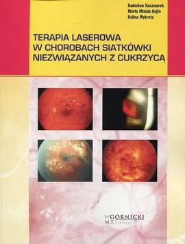 Terapia laserowa w chorobach siatkówki niezwiązanych z cukrzycą - Radosław Kaczmarek, Marta Misiuk-Hojło, Halina Wykrota
