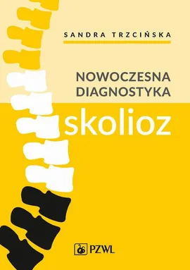 Nowoczesna diagnostyka skolioz - Andrzej Myśliwiec, Arkadiusz Żurawski, Kamil Koszela, Sandra Trzcińska