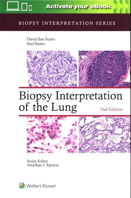 Biopsy Interpretation of the Lung Second edition - Saul Suster, David Suster