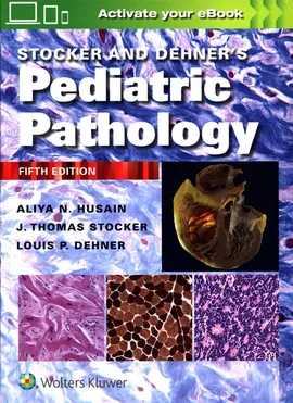 Stocker and Dehner's Pediatric Pathology Fifth edition - Husain Aliya N., Dehner Louis P.