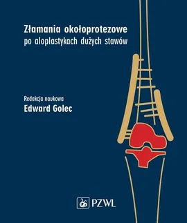 Złamania okołoprotezowe po aloplastykach dużych stawów - Outlet - Edward Golec