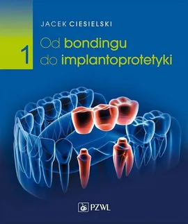 Od bondingu do implantoprotetyki Część 1 - Jacek Ciesielski