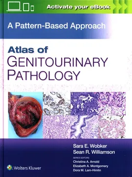Atlas of Genitourinary Pathology - Williamson Sean R., Wobker Sara E.