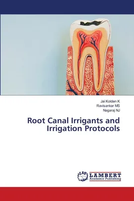 Root Canal Irrigants and Irrigation Protocols - Jai Kolden K