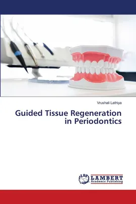 Guided Tissue Regeneration in Periodontics - Vrushali Lathiya
