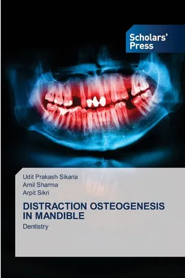 DISTRACTION OSTEOGENESIS IN MANDIBLE - Udit Prakash Sikaria