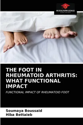 THE FOOT IN RHEUMATOID ARTHRITIS - Soumaya Boussaid