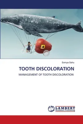 TOOTH DISCOLORATION - Somya Sahu