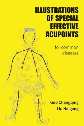 Illustrations Of Special Effective Acupoints for common Diseases