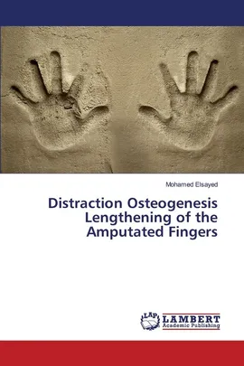 Distraction Osteogenesis Lengthening of the Amputated Fingers - Mohamed Elsayed