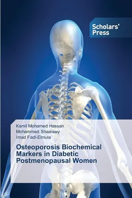 Osteoporosis Biochemical Markers in Diabetic Postmenopausal Women - Hassan Kamil Mohamed