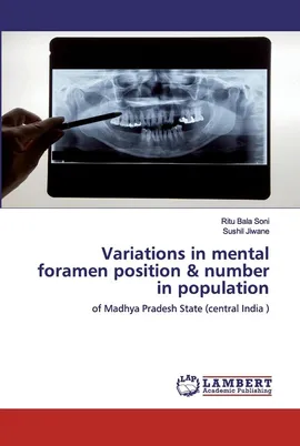 Variations in mental foramen position & number in population - Ritu Bala Soni